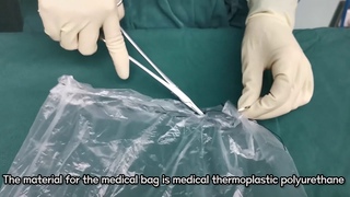 Laparoscopic myomectomy using self-made retrieval bag to contain tissue extraction
