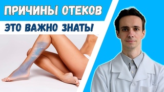 ПОЧЕМУ ОТЕКАЮТ НОГИ Асцит. Болезни сердца. Недостаток белка....