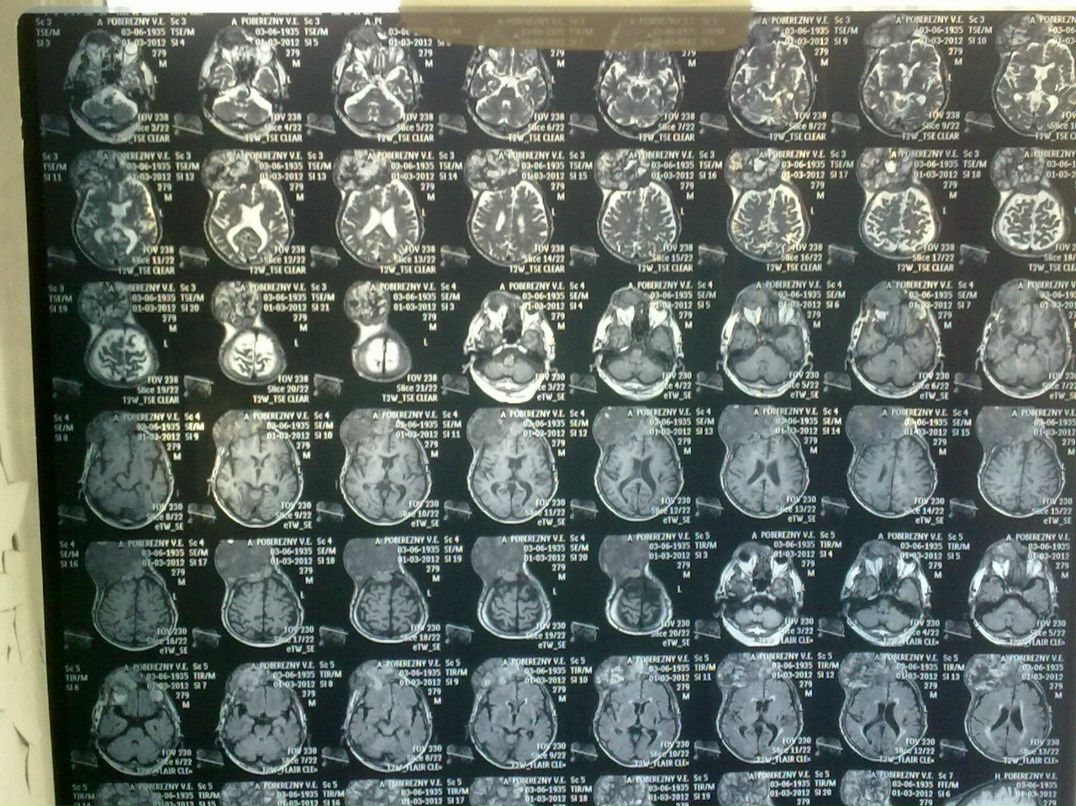 Эльгюн Мамедов | Москва