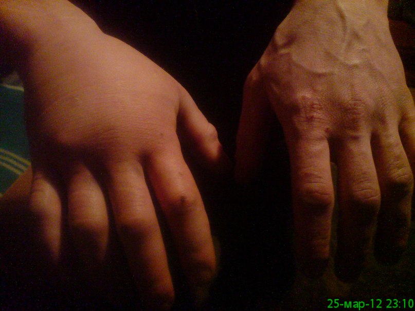 Саня Гариком НаполеОн | Отрадная