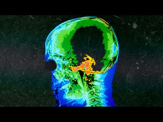 A Boy Ate 180 Gummy Melatonins For Lunch. This Is What Happened To His Brain.