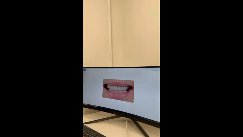 Видео от Implant