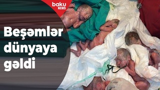 Azərbaycanda ilk dəfə beşəm dünyaya gəlib