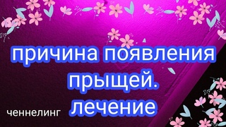 Прыщи, акне, угри, Причины и лечение. Потоковый ченнелинг